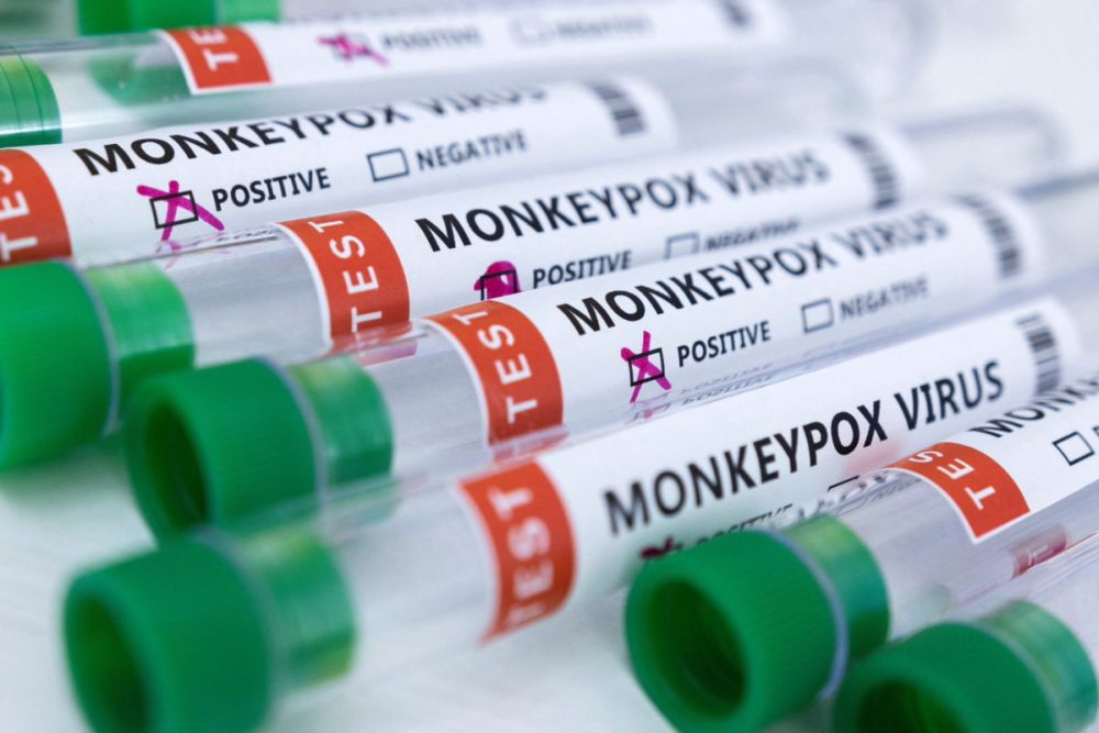 No monkeypox cases recorded so far in Galway